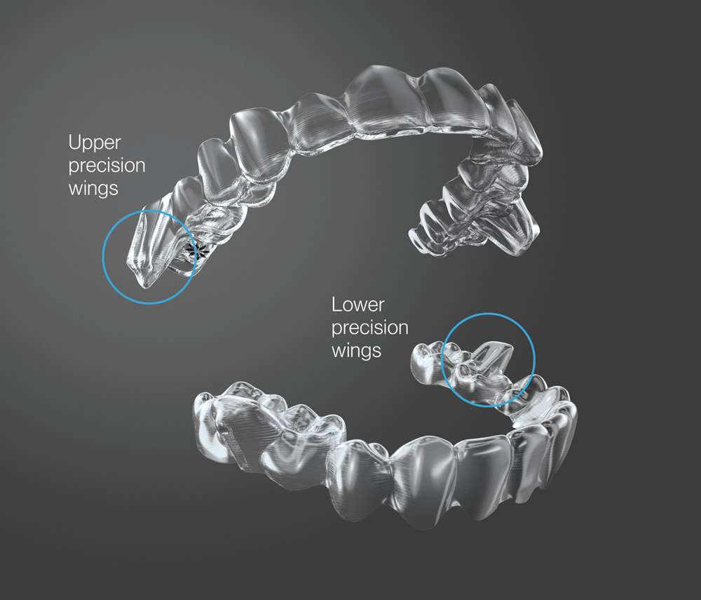 BA ĐẶC ĐIỂM NHẬN DẠNG KHAY INVISALIGN