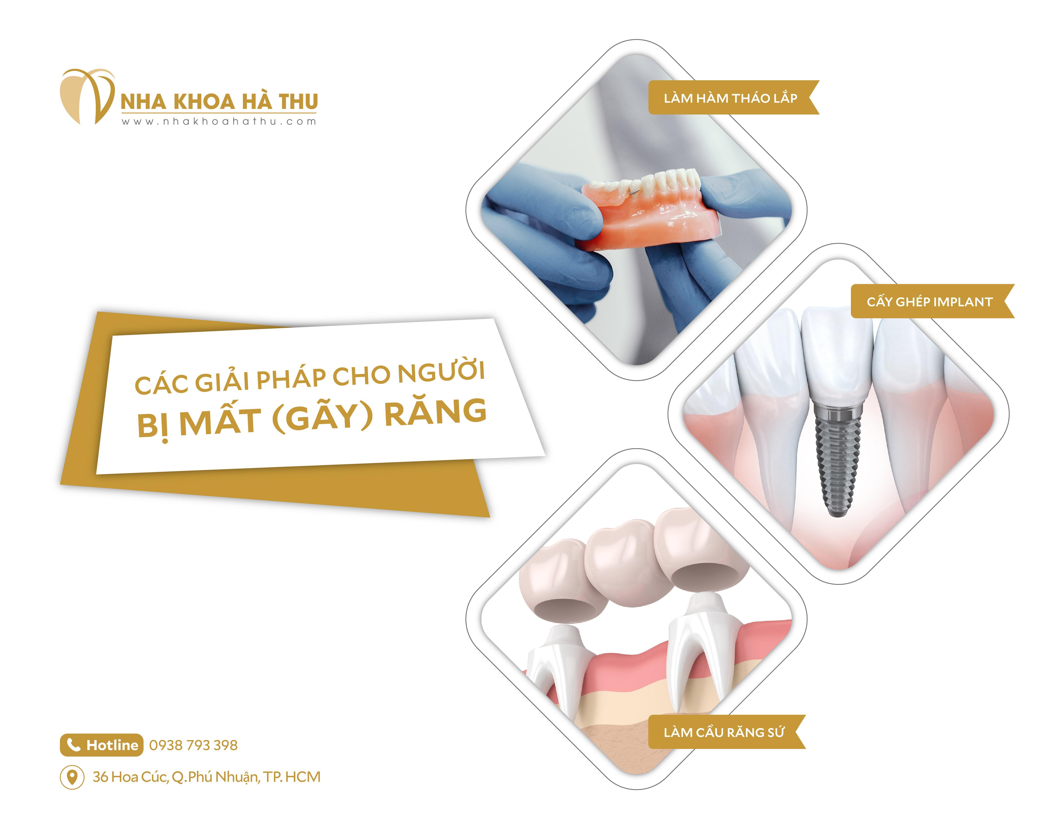 Các giải pháp cho người mất răng