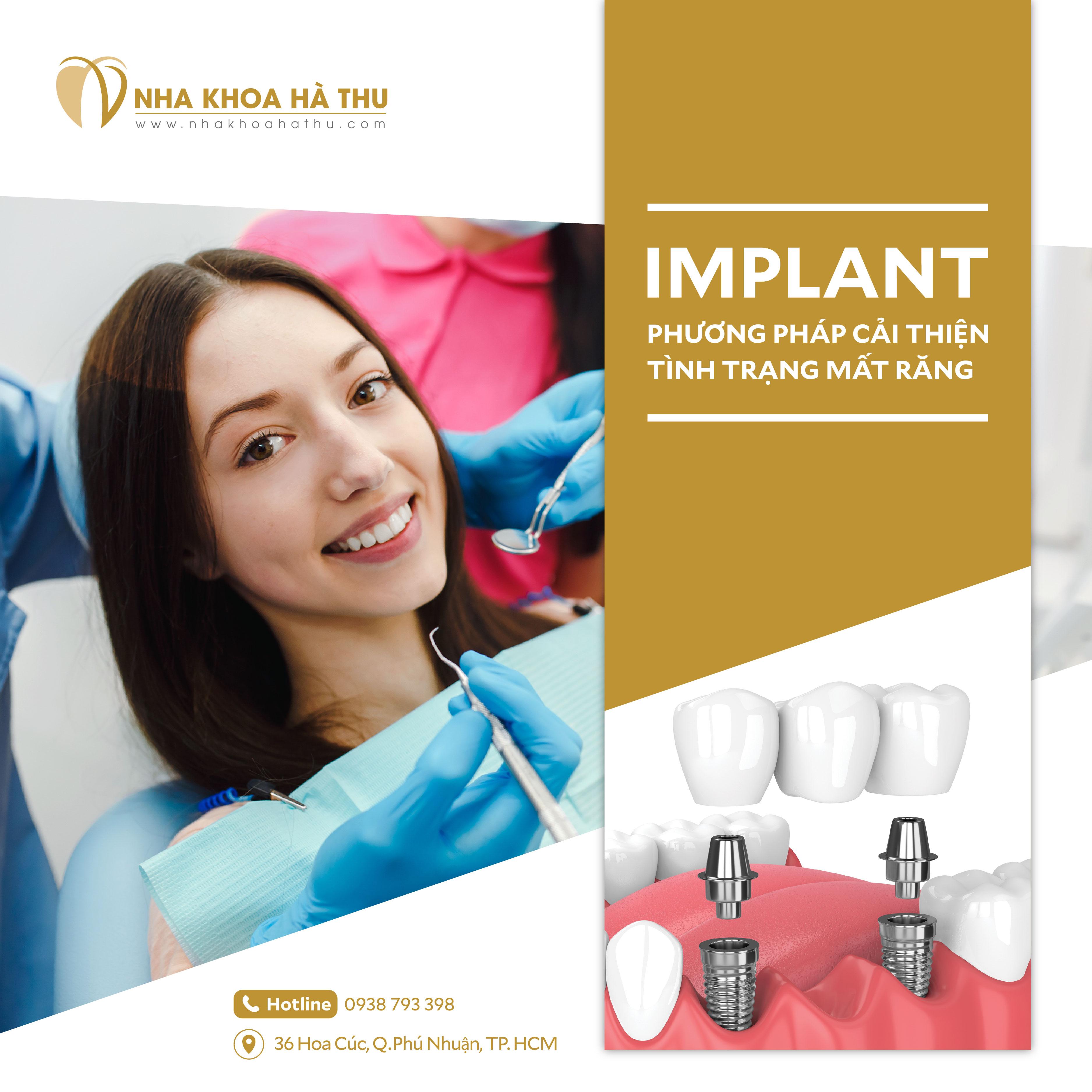 Implant chất lượng