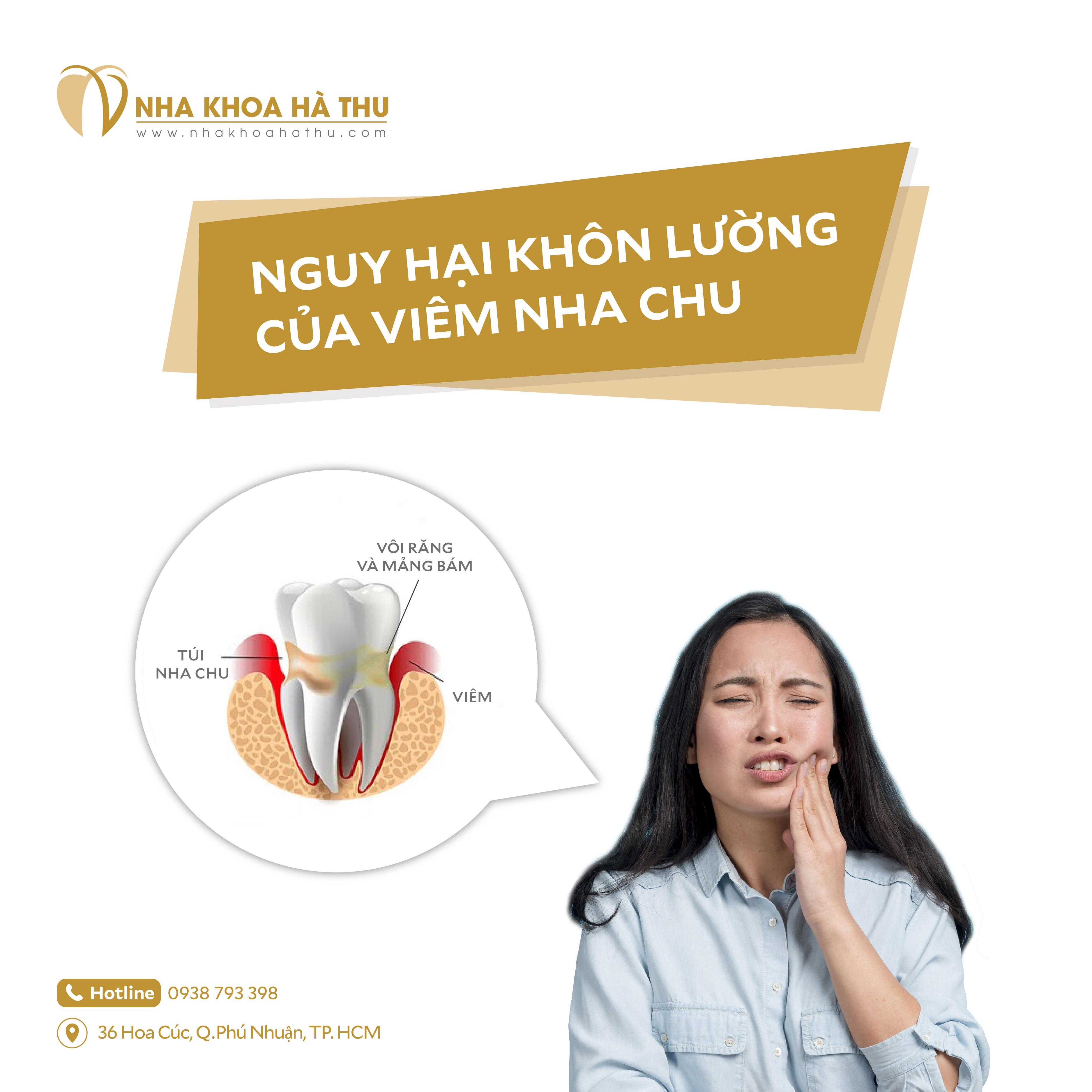 Viêm nha chu là tình trạng tổ chức xung quanh răng bao gồm nướu răng, xương ổ răng, dây chằng (dây chằng nha chu), gai nướu (phần nhô ra của nha chu nằm phía dưới các răng) bị nhiễm trùng.